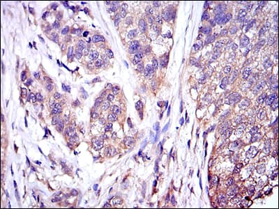 MAPK3 / ERK1 Antibody (clone 1E5)