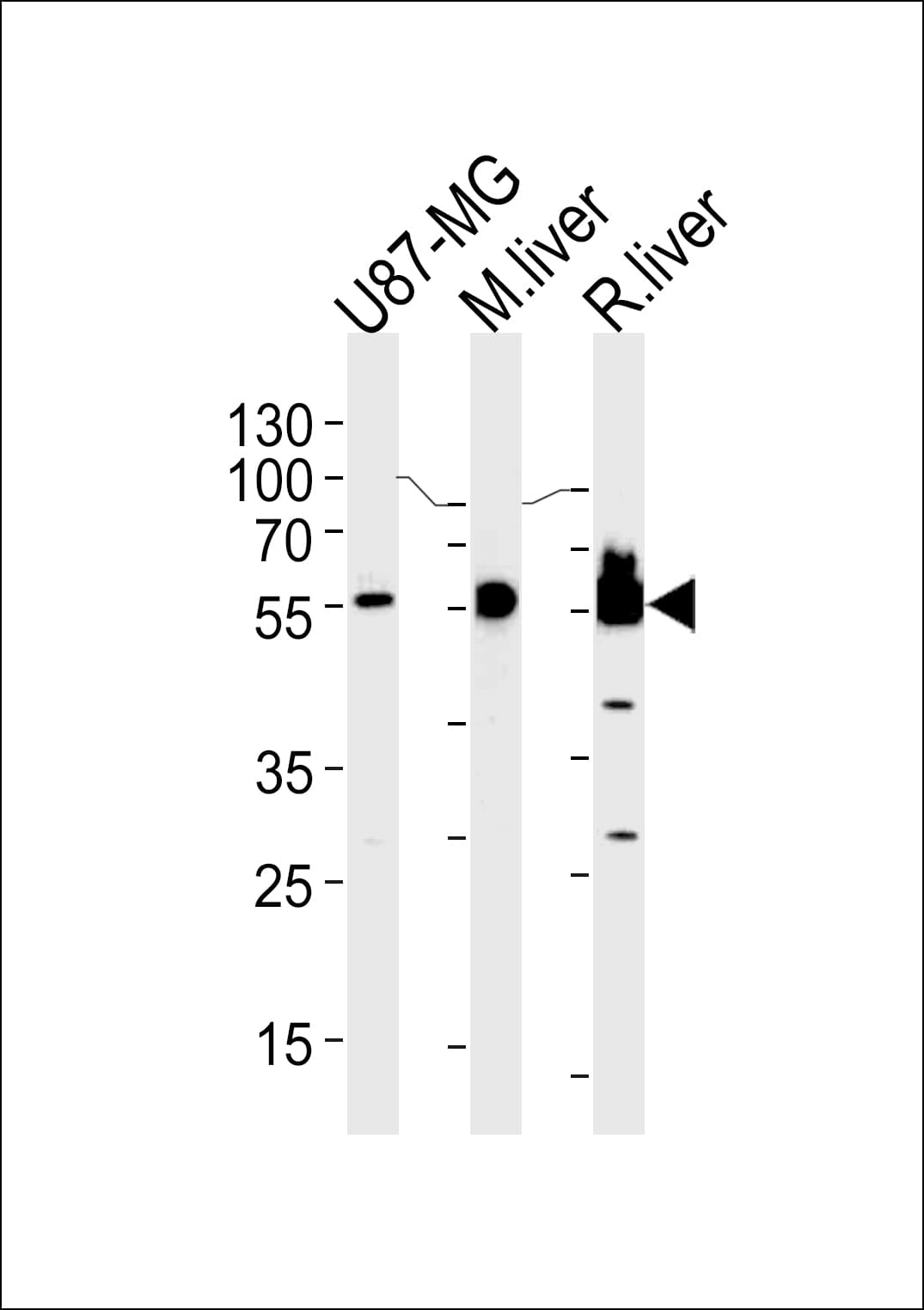 HMGCS1 / HMG-CoA Synthase 1 Antibody (aa290-317)