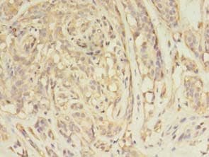 ARFIP2 / Arfaptin 2 Antibody