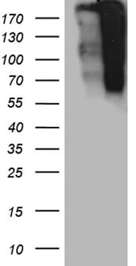 TP53BP1 / 53BP1 Antibody (aa1-300, clone OTI2G3)