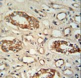 PPM1L Antibody (aa215-244)