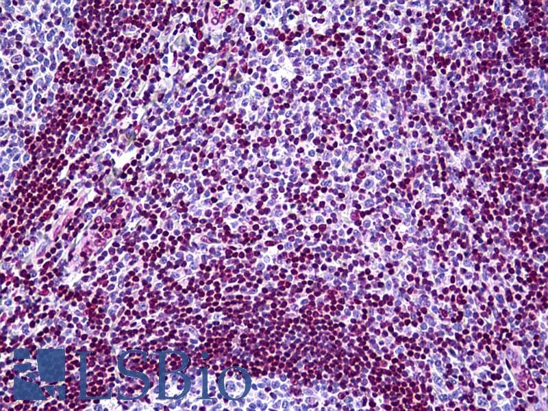 IHC-plus™ MECP2 Antibody (clone 4B6)