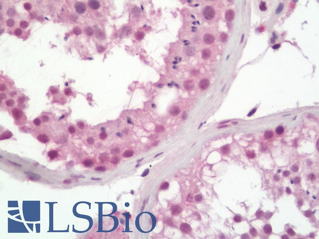 IHC-plus™ PALB2 Antibody (aa675-725)
