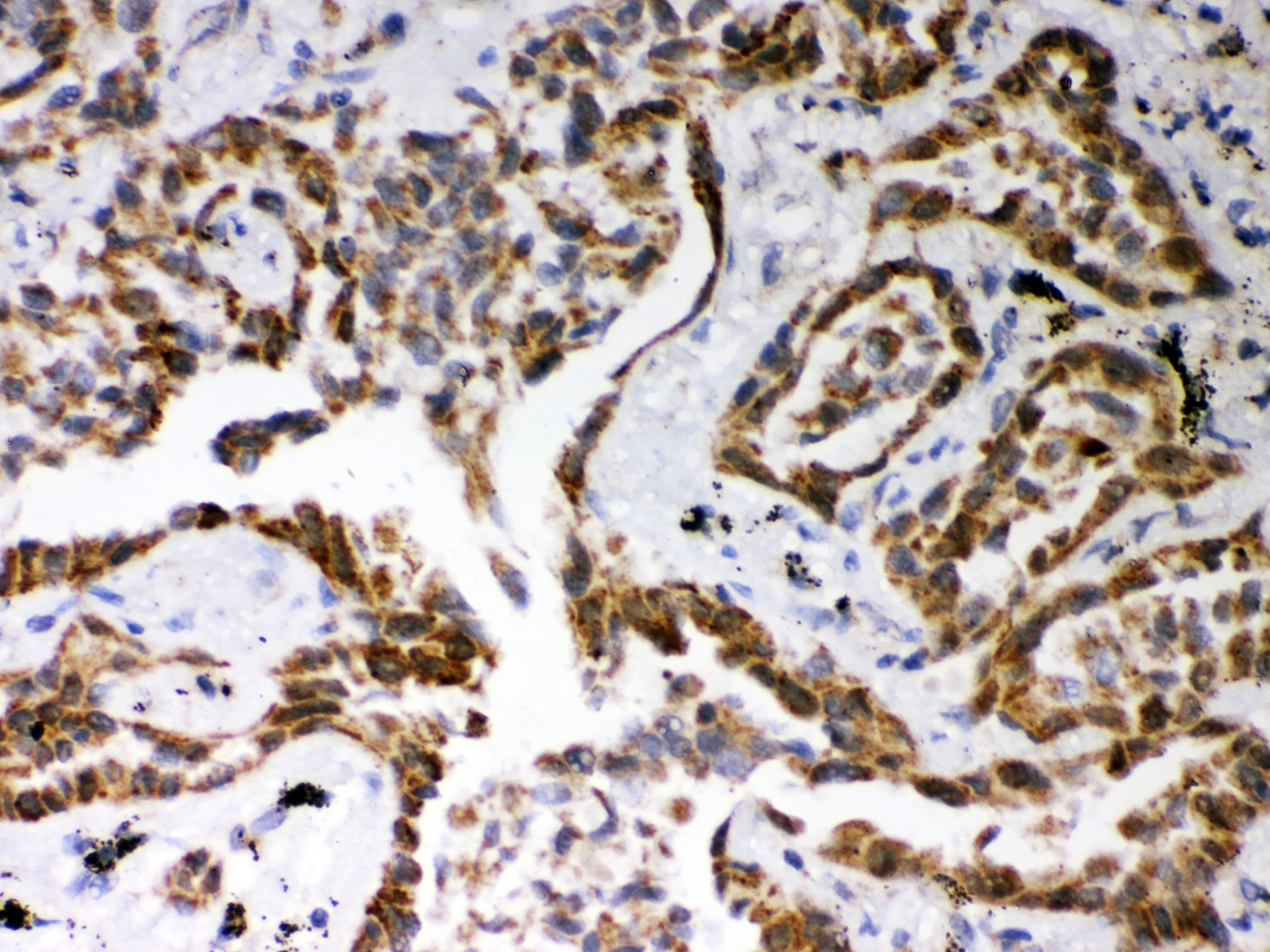 SELP / P-Selectin / CD62P Antibody (aa42-271)