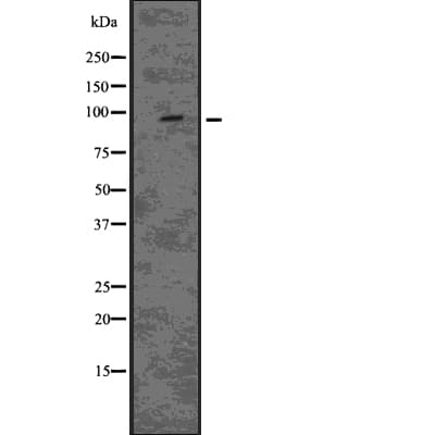 EPS15L1 / EPS15R Antibody