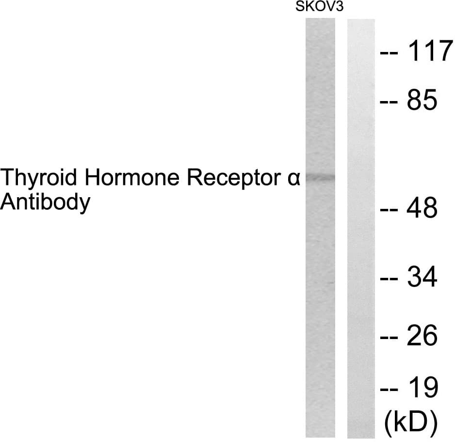 THRA / THR Alpha Antibody (aa10-59)