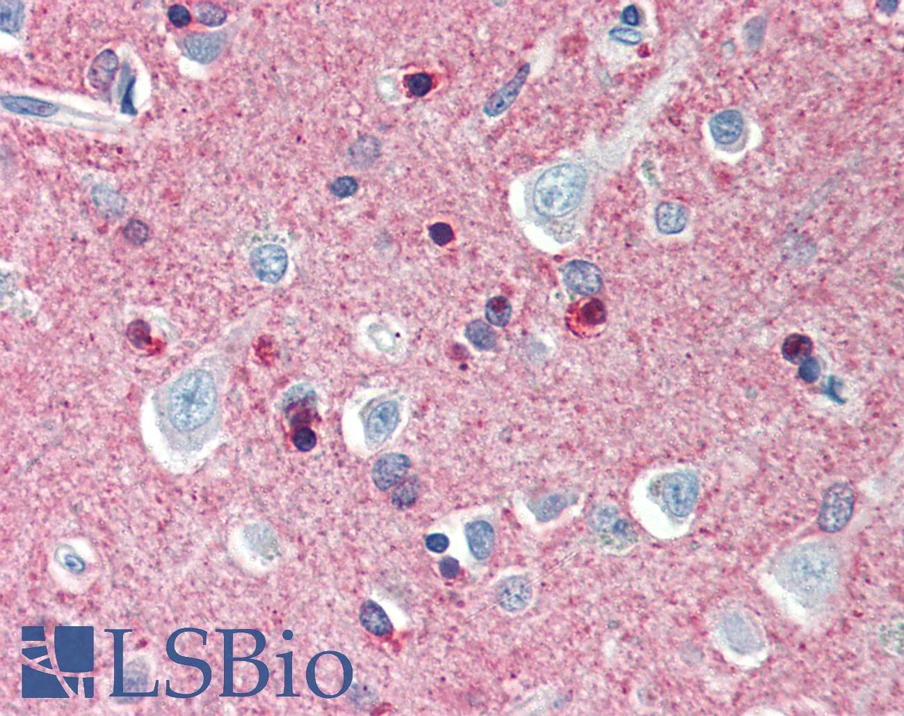 IHC-plus™ CRMP1 Antibody