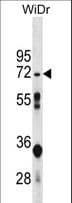 Polyclonal Rabbit anti-Human NT5C2 Antibody (aa5-33, WB)