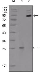 IHC-plus™ EPHB2 / EPH Receptor B2 Antibody (aa17-200, clone 2D12C6)