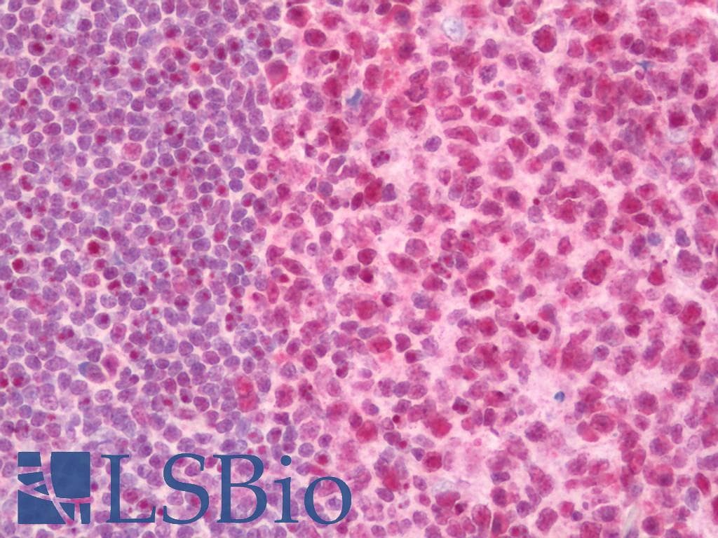 IHC-plus™ PARN Antibody