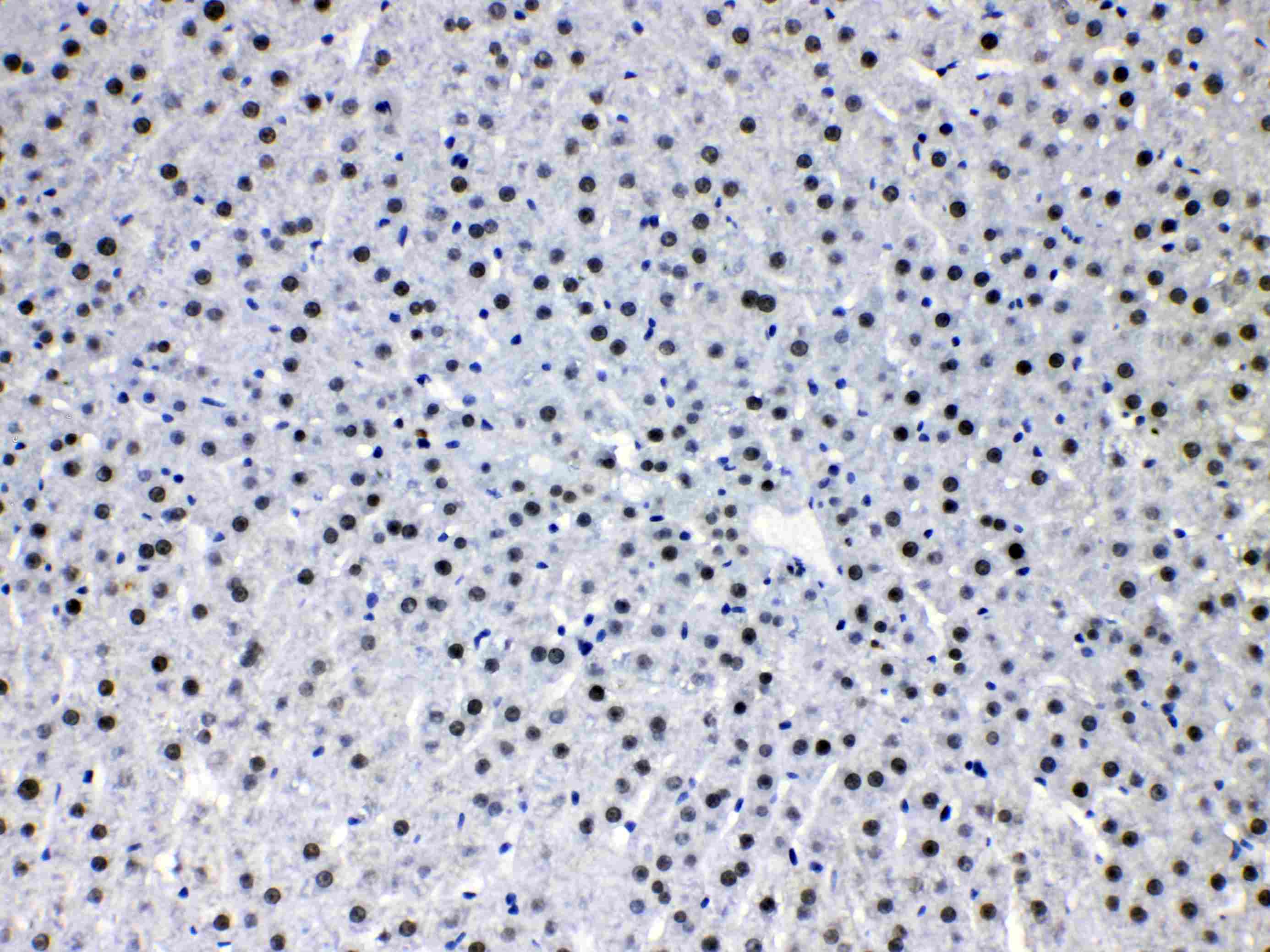 HDGF Antibody
