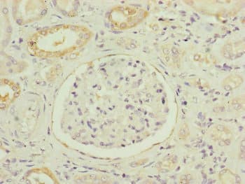 Polyclonal Rabbit anti-Human NDUFB5 Antibody (IHC, IF, WB)