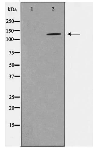 GRIN1 / NMDAR1 Antibody (phospho-Ser897)