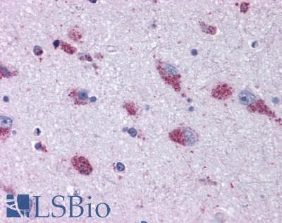 PathPlus™ MRGPRX2 / MRGX2 Antibody (Extracellular Domain)