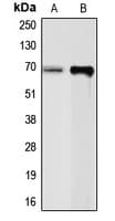 IHC-plus™ Polyclonal Rabbit anti-Human CHGA / Chromogranin A Antibody (Internal, IHC, WB)