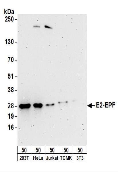 Polyclonal Rabbit anti-Human UBE2S / E2 EPF Antibody (aa172-222, WB)