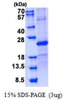 Human USAG1 / SOSTDC1 Protein (Recombinant His)