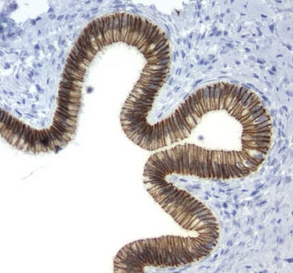Monoclonal Mouse anti-Human CDH1 / E Cadherin Antibody (clone UMAB184, Carrier-free, IHC, IF, WB)