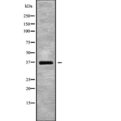 Polyclonal Rabbit anti-Human DNAJB2 Antibody (WB)