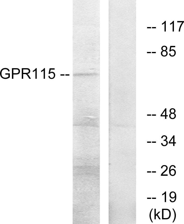 Polyclonal Rabbit anti-Human ADGRF4 / GPR115 Antibody (WB)