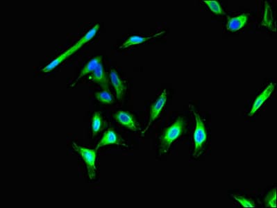 CIB2 / KIP2 Antibody
