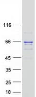 Human ACADVL Protein (Recombinant Myc-DDK (Flag))
