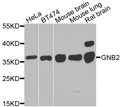 Polyclonal Rabbit anti-Human GNB2 Antibody (WB)