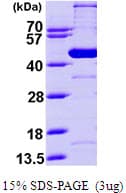 Human GCD / GCDH Protein (Recombinant His)