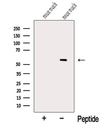 MYOT / Myotilin Antibody