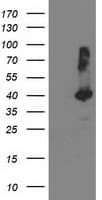 TBC1D21 Antibody (clone OTI8C1)