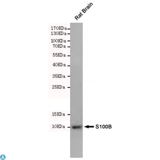 S100B / S100 Beta Antibody