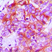 PathPlus™ Polyclonal Rabbit anti-Human CD95 / FAS Antibody (C-Terminus, IHC, WB)