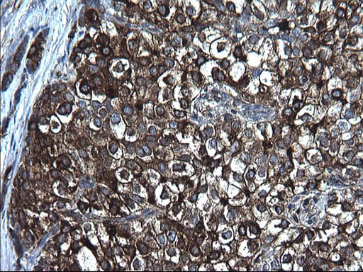 FGG / Fibrinogen Gamma Antibody (clone OTI2D2)