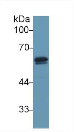 GC / Vitamin D-Binding Protein Antibody (aa205-403, PE)