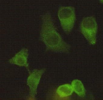 IHC-plus™ KIF11 / EG5 Antibody