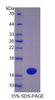 Mouse OTOR / Otoraplin Protein (Recombinant His-T7, N-terminus)