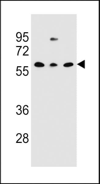 CLEC17A Antibody (aa176-203)