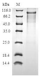 Human PIBF1 / PIBF Protein (Recombinant 10His, N-terminus + Myc, C-terminus)