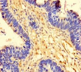 OTUB1 / OTU1 Antibody
