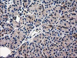 CAT / Catalase Antibody (clone OTI1B8)