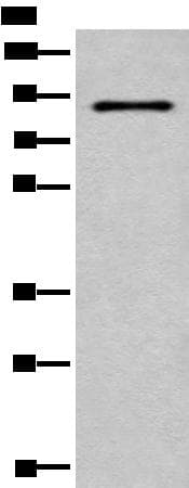 Complement C7 Antibody