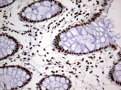 Monoclonal Mouse anti-Human HNRPM / HNRNPM Antibody (clone OTI1F6, aa1-261, IHC, WB)