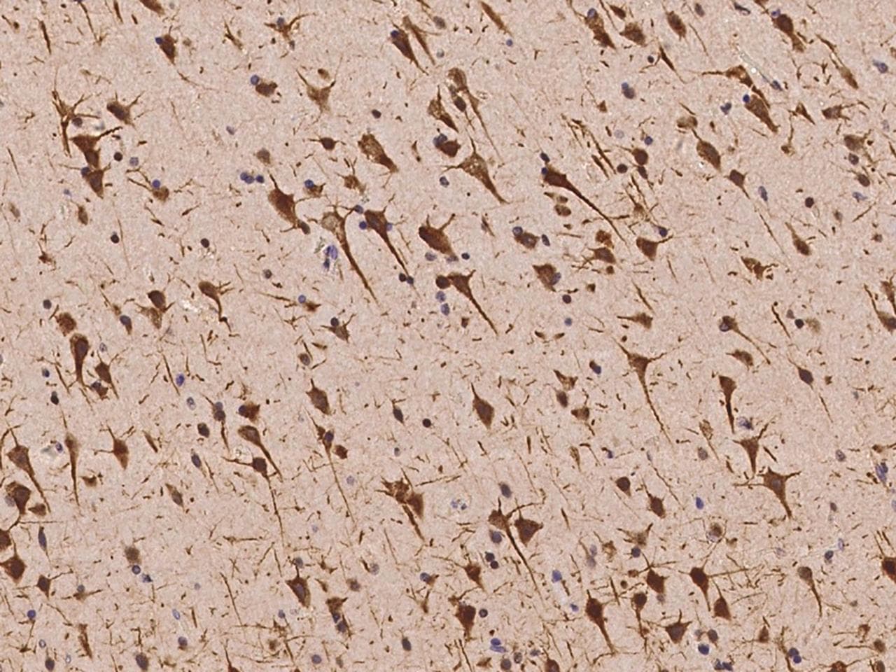 Polyclonal Rabbit anti-Human CCSAP Antibody (IHC)
