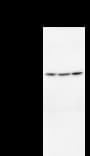 Monoclonal Mouse anti-Human SCML2 Antibody (clone SCMAD14A, WB)