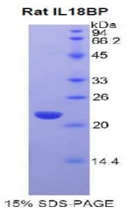 Rat IL18BP Protein (Recombinant His)