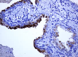TCL / RHOJ Antibody (clone OTI2C11)