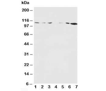 GRIN1 / NMDAR1 Antibody (aa36-53)