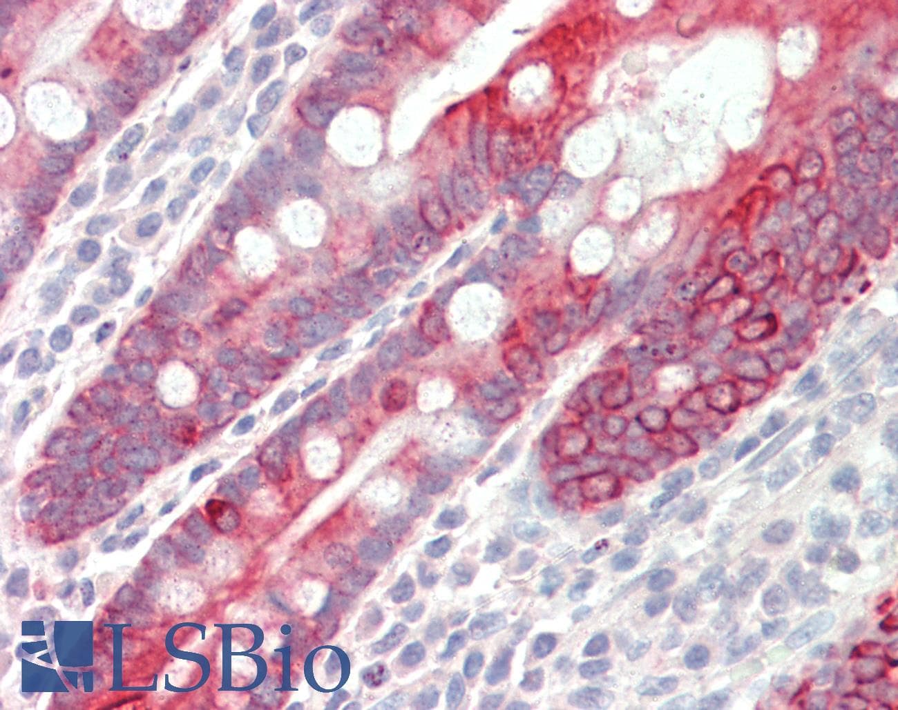 PathPlus™ KRT18 / CK18 / Cytokeratin 18 Antibody (aa200-300)