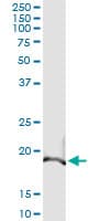 BAK1 / BAK Antibody (clone 1E4)