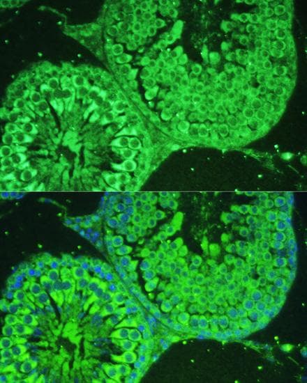 Polyclonal Rabbit anti-Human ASZ1 / Orf3 Antibody (IHC, IF)